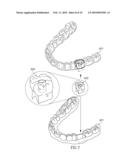 Universal Template Enabling Drilling and Placing a Dental Implant Into A Patient s Jaw diagram and image