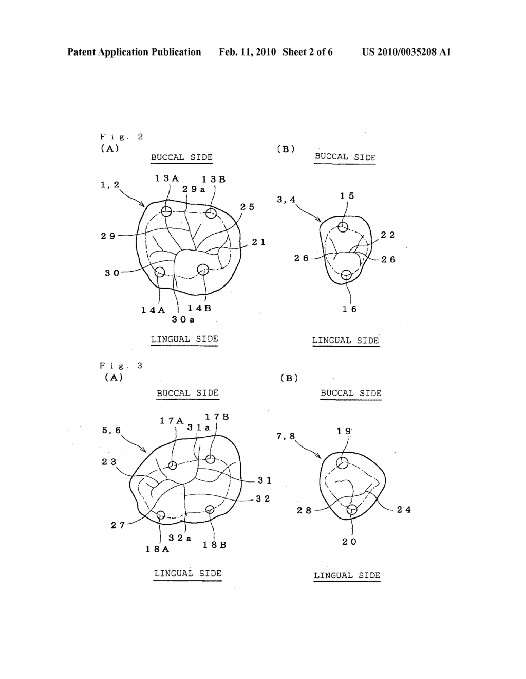 Artificial teeth - diagram, schematic, and image 03