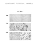 COMPOSITIONS AND METHODS FOR TISSUE-BASED PROTEIN TRUNCATION TEST FOR DISEASE DIAGNOSIS diagram and image