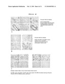 COMPOSITIONS AND METHODS FOR TISSUE-BASED PROTEIN TRUNCATION TEST FOR DISEASE DIAGNOSIS diagram and image