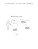 USE OF COMMON GAMMA CHAIN CYTOKINES FOR THE VISUALIZATION, ISOLATION AND GENETIC MODIFICATION OF MEMORY T LYMPHOCYTES diagram and image