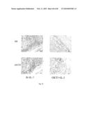 USE OF COMMON GAMMA CHAIN CYTOKINES FOR THE VISUALIZATION, ISOLATION AND GENETIC MODIFICATION OF MEMORY T LYMPHOCYTES diagram and image