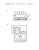 Prognostic Methods in Colorectal Cancer diagram and image