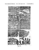 METHOD OF TREATING INTRAUTERINE INFLAMMATION diagram and image