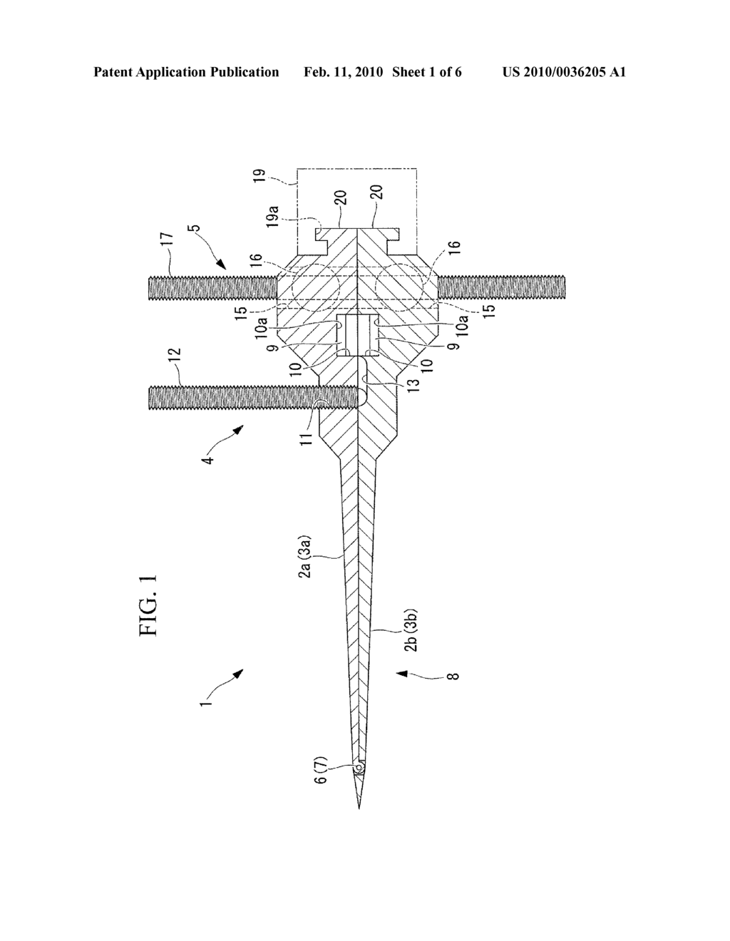 SPREADER FOR HIGH TIBIAL OSTEOTOMY - diagram, schematic, and image 02