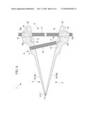 SPREADER FOR HIGH TIBIAL OSTEOTOMY diagram and image