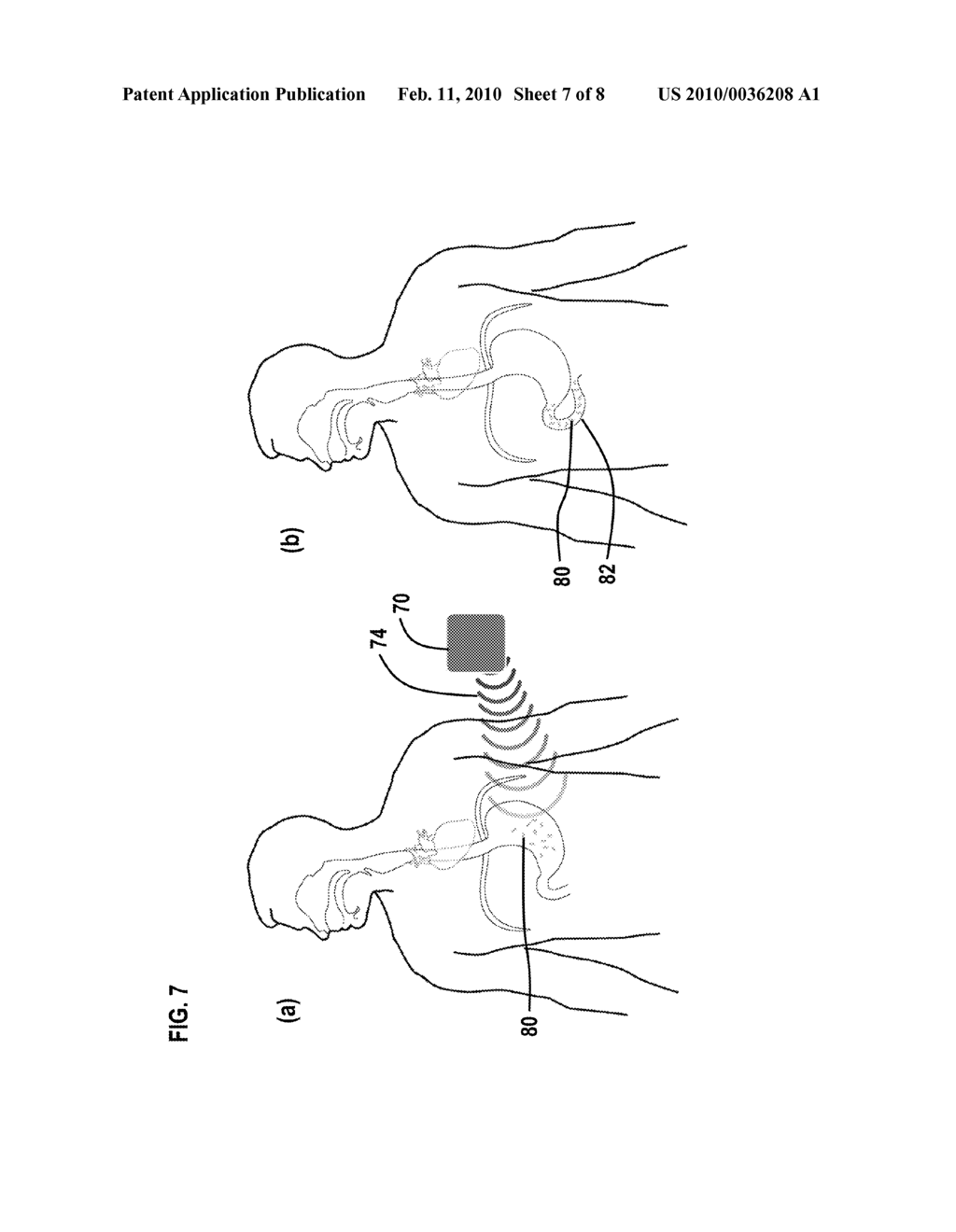 METHOD AND APPARATUS FOR IN-VIVO PHYSIOLOGICAL MONITORING - diagram, schematic, and image 08