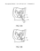 APPARATUS, METHOD AND SYSTEM FOR DETERMINING A PHYSIOLOGICAL CONDITION WITHIN A MAMMAL diagram and image