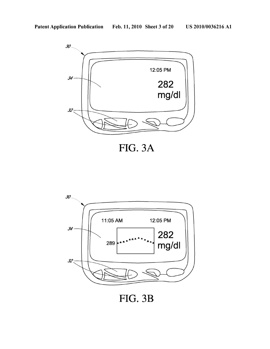 SYSTEMS AND METHODS FOR REPLACING SIGNAL ARTIFACTS IN A GLUCOSE SENSOR DATA STREAM - diagram, schematic, and image 04