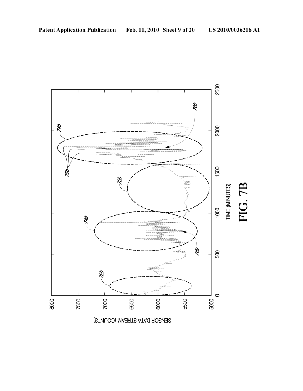 SYSTEMS AND METHODS FOR REPLACING SIGNAL ARTIFACTS IN A GLUCOSE SENSOR DATA STREAM - diagram, schematic, and image 10