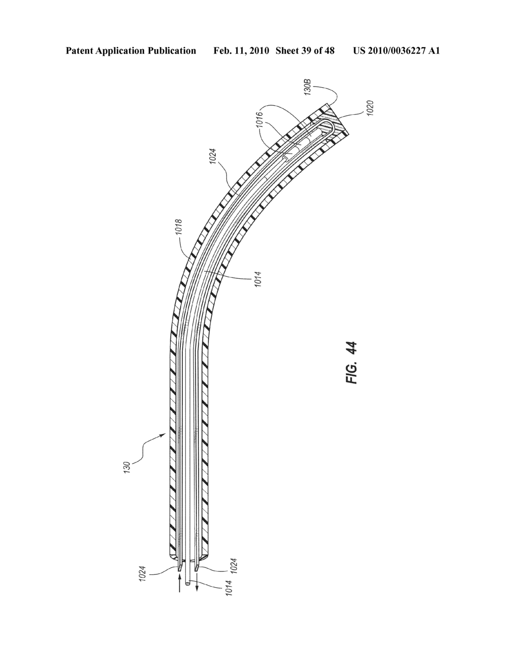 APPARATUS AND DISPLAY METHODS RELATING TO INTRAVASCULAR PLACEMENT OF A CATHETER - diagram, schematic, and image 40