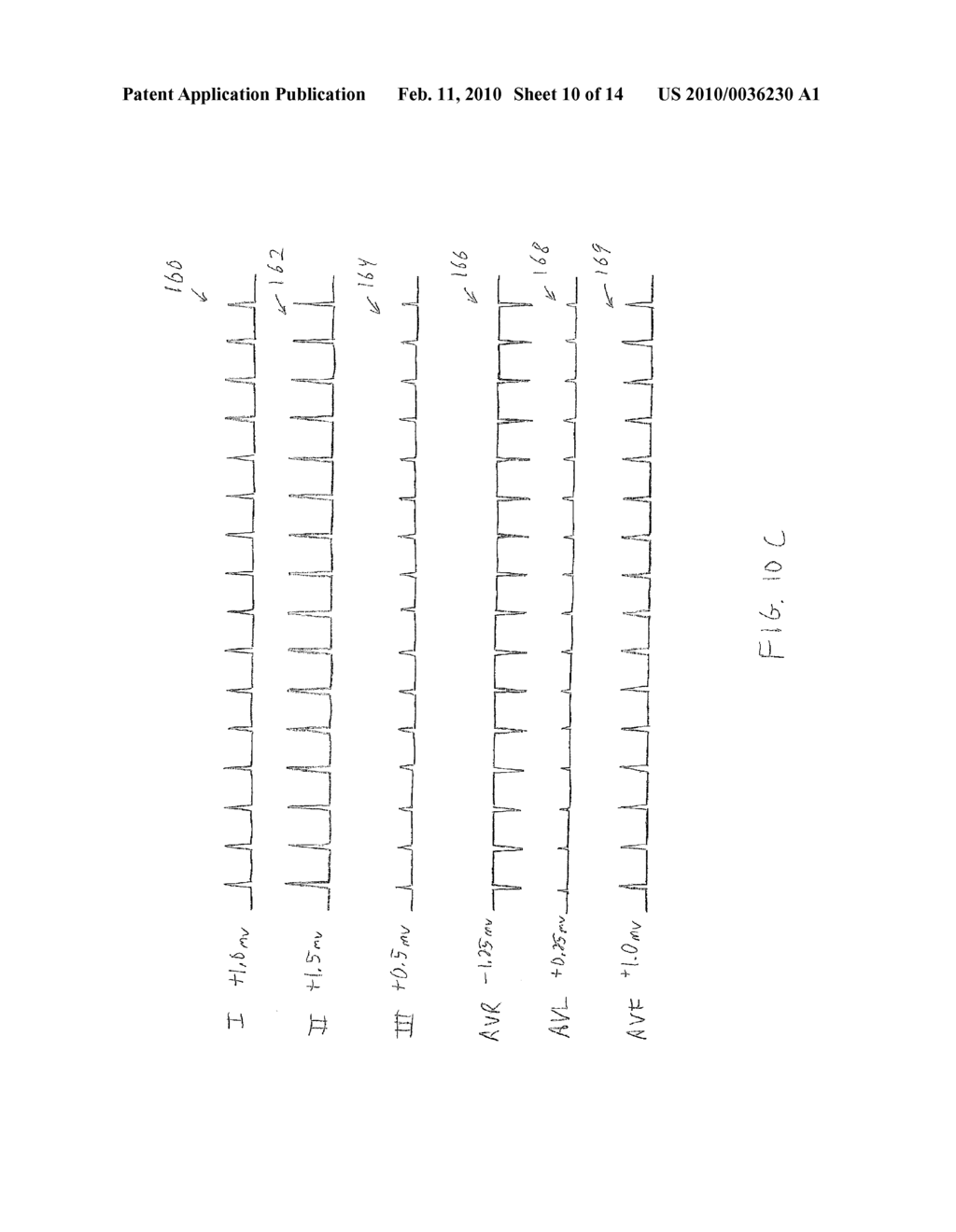 Multiple Electrode Composite Systems and Methods for Use in Electrocardiogram Detection Systems - diagram, schematic, and image 11