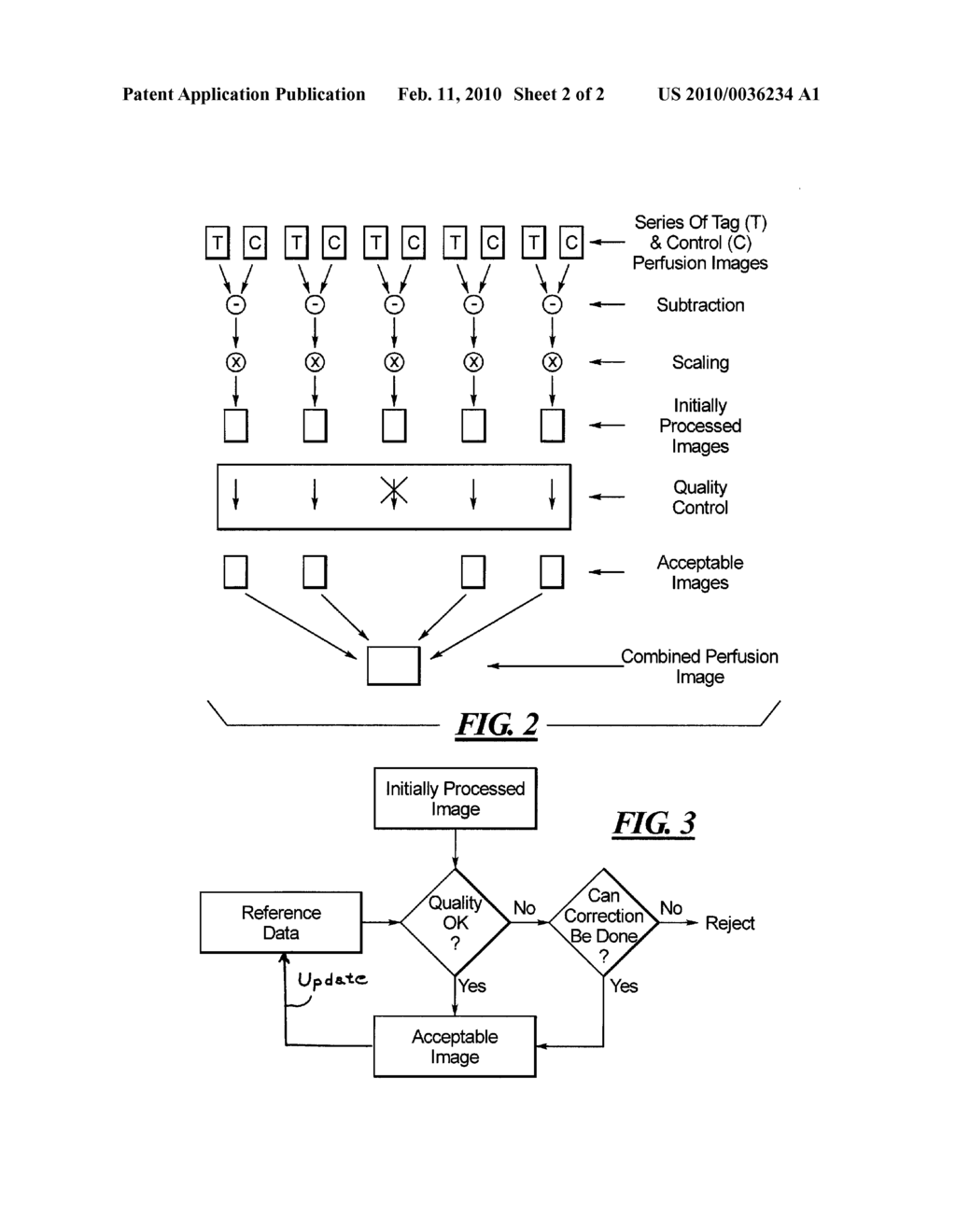 MAGNETIC RESONANCE METHOD AND APPARATUS FOR GENERATING A PERFUSION IMAGE - diagram, schematic, and image 03