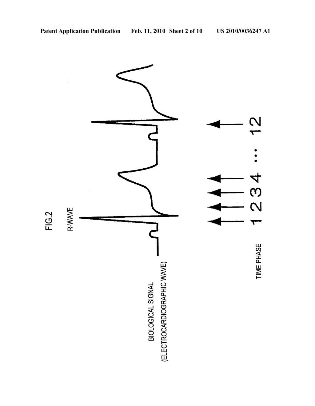 ULTRASONIC DIAGNOSIS APPARATUS - diagram, schematic, and image 03