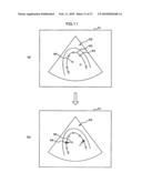 MEDICAL IMAGE DIAGNOSTIC APPARATUS, MEDICAL IMAGE MEASURING METHOD, AND MEDICLA IMAGE MEASURING PROGRAM diagram and image