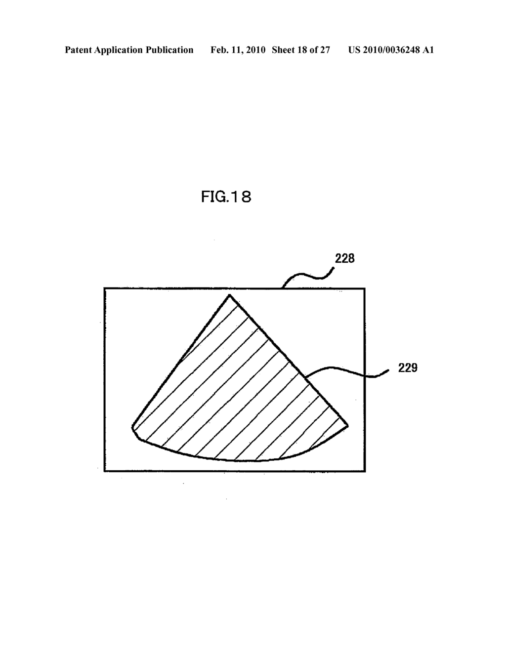 MEDICAL IMAGE DIAGNOSTIC APPARATUS, MEDICAL IMAGE MEASURING METHOD, AND MEDICLA IMAGE MEASURING PROGRAM - diagram, schematic, and image 19