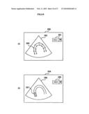 MEDICAL IMAGE DIAGNOSTIC APPARATUS, MEDICAL IMAGE MEASURING METHOD, AND MEDICLA IMAGE MEASURING PROGRAM diagram and image