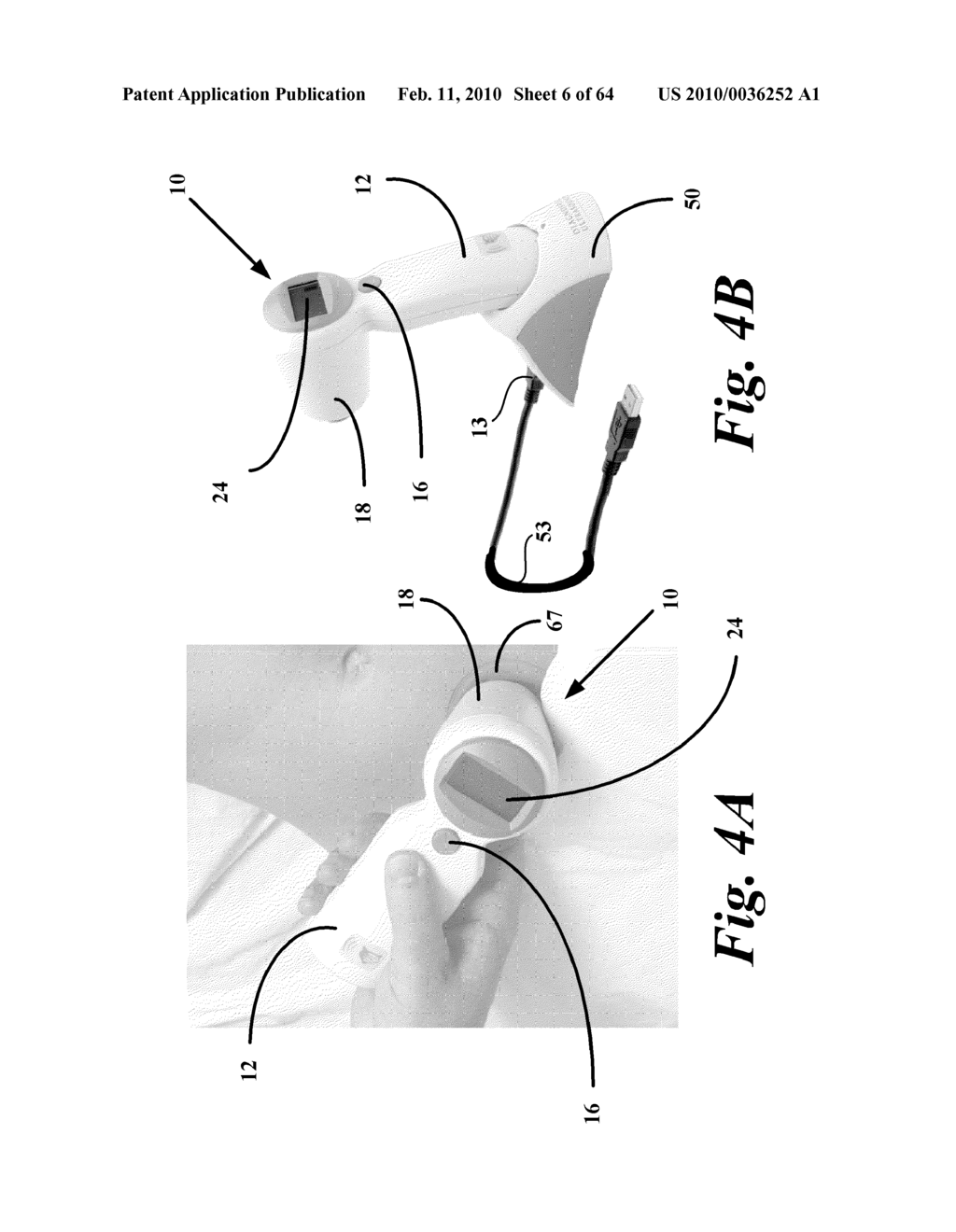 ULTRASOUND SYSTEM AND METHOD FOR MEASURING BLADDER WALL THICKNESS AND MASS - diagram, schematic, and image 07