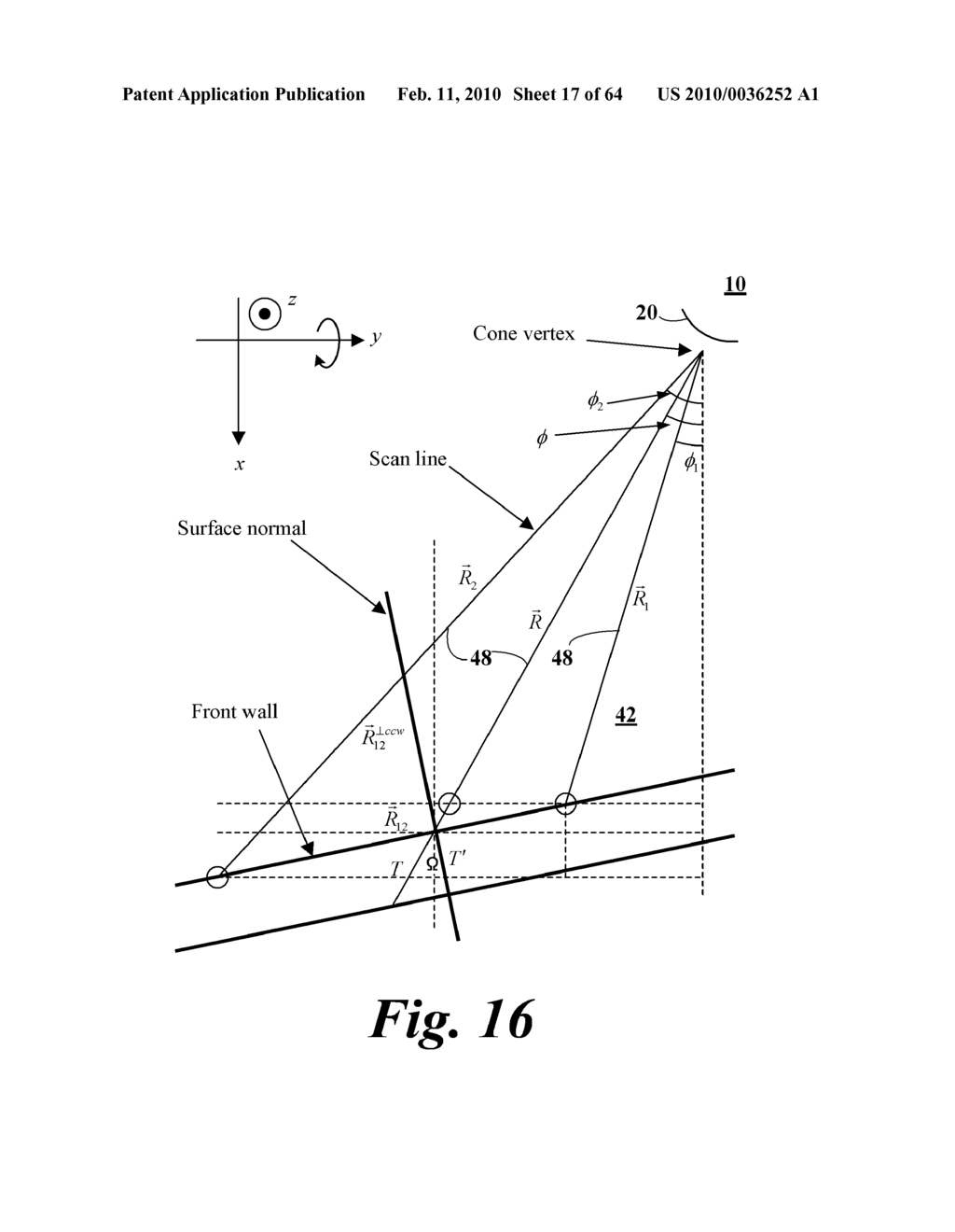 ULTRASOUND SYSTEM AND METHOD FOR MEASURING BLADDER WALL THICKNESS AND MASS - diagram, schematic, and image 18