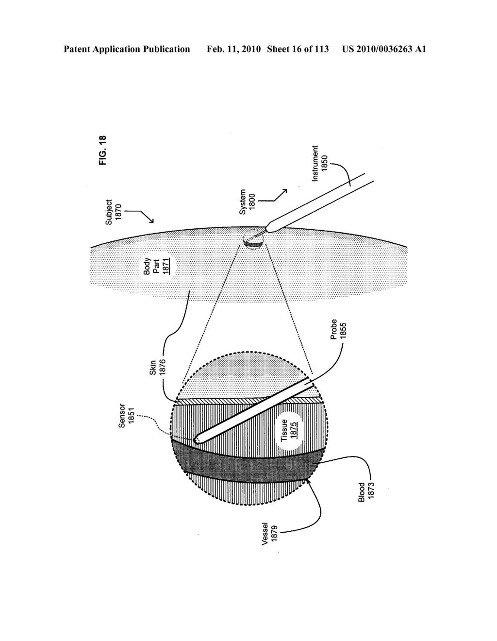 Circulatory monitoring systems and methods - diagram, schematic, and image 17