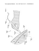 Circulatory monitoring systems and methods diagram and image