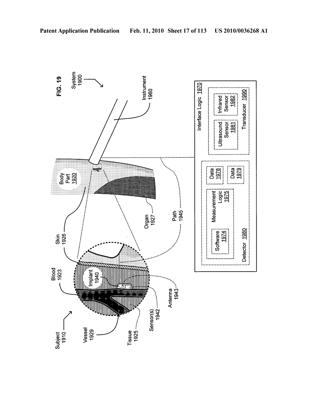 Circulatory monitoring systems and methods - diagram, schematic, and image 18