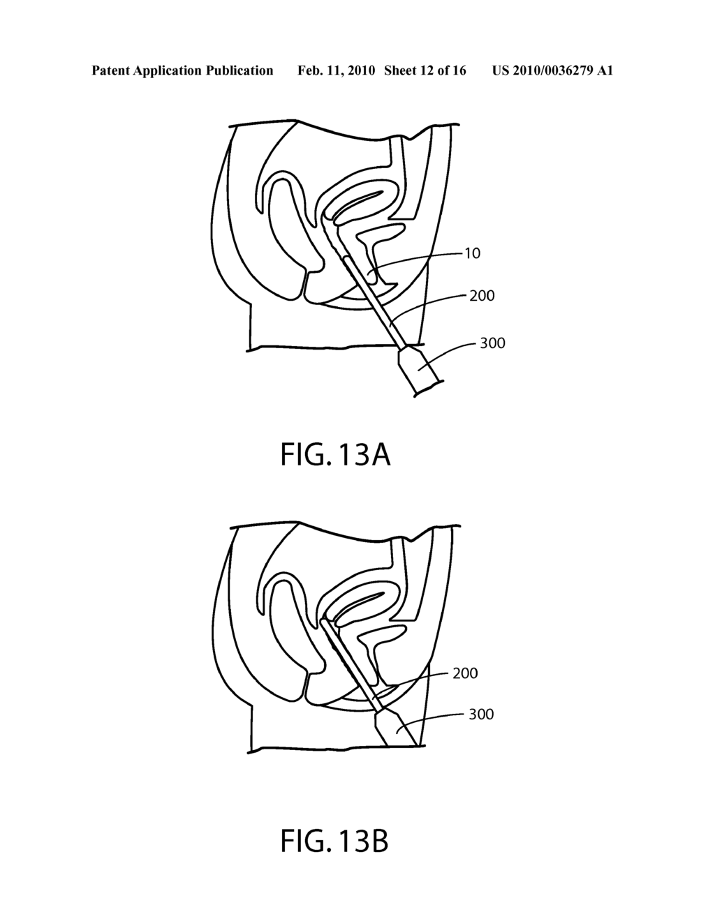 APPARATUS, METHOD AND SYSTEM FOR DETERMINING A PHYSIOLOGICAL CONDITION WITHIN A MAMMAL - diagram, schematic, and image 13