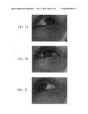 Apparatus and Methods for Assessment of Vestibulo-Ocular Reflexes diagram and image