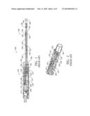 HIFU treatment probe diagram and image