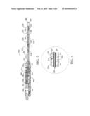 HIFU treatment probe diagram and image