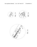 HIFU treatment probe diagram and image