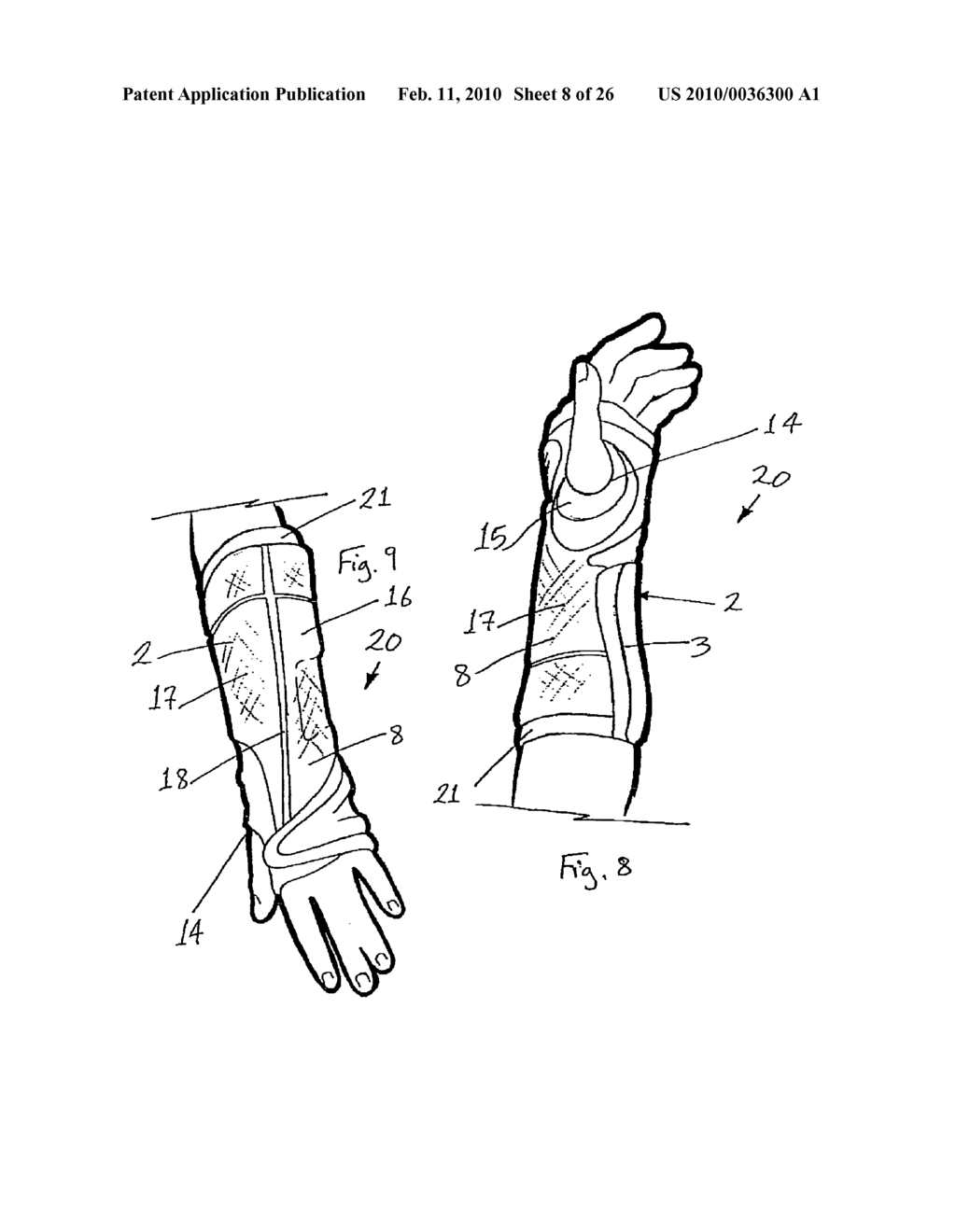 Orthopaedic Devices - diagram, schematic, and image 09