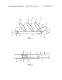 APPARATUS AND METHODS FOR REMOVING OBSTRUCTIVE MATERIAL FROM BODY LUMENS diagram and image