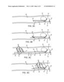 APPARATUS AND METHODS FOR REMOVING OBSTRUCTIVE MATERIAL FROM BODY LUMENS diagram and image