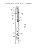 APPARATUS AND METHODS FOR REMOVING OBSTRUCTIVE MATERIAL FROM BODY LUMENS diagram and image