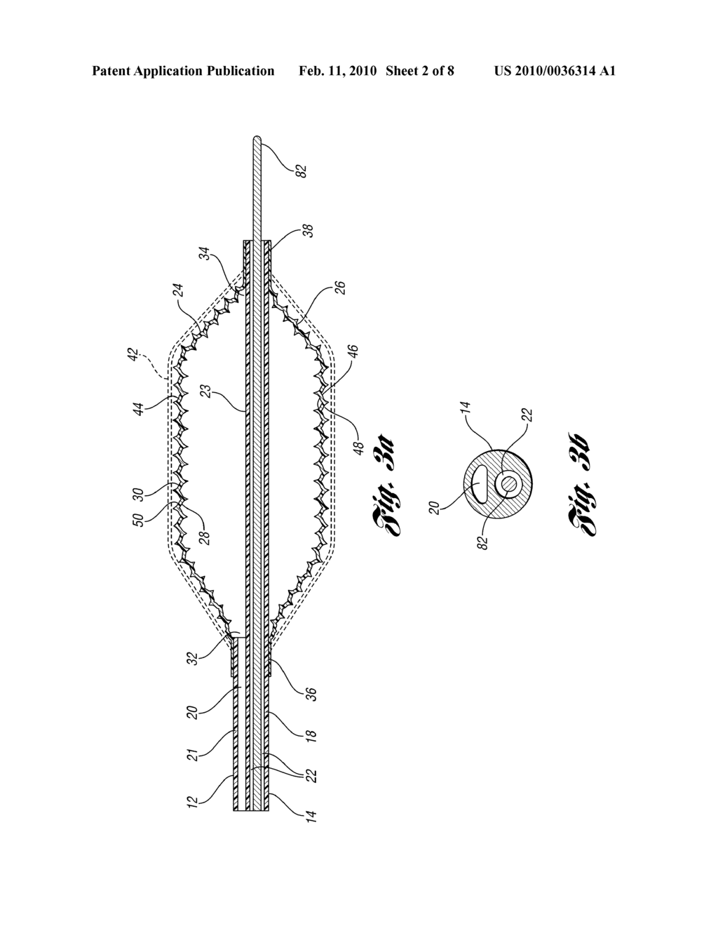 BALLOON CATHETER AND METHOD FOR MAKING SAME - diagram, schematic, and image 03