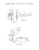 STENT GRAFT DELIVERY SYSTEM diagram and image