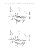 STENT GRAFT DELIVERY SYSTEM diagram and image