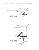 STENT GRAFT DELIVERY SYSTEM diagram and image