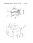 STENT GRAFT DELIVERY SYSTEM diagram and image