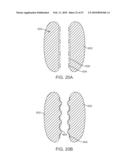 STENT GRAFT DELIVERY SYSTEM diagram and image