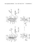 STENT GRAFT DELIVERY SYSTEM diagram and image