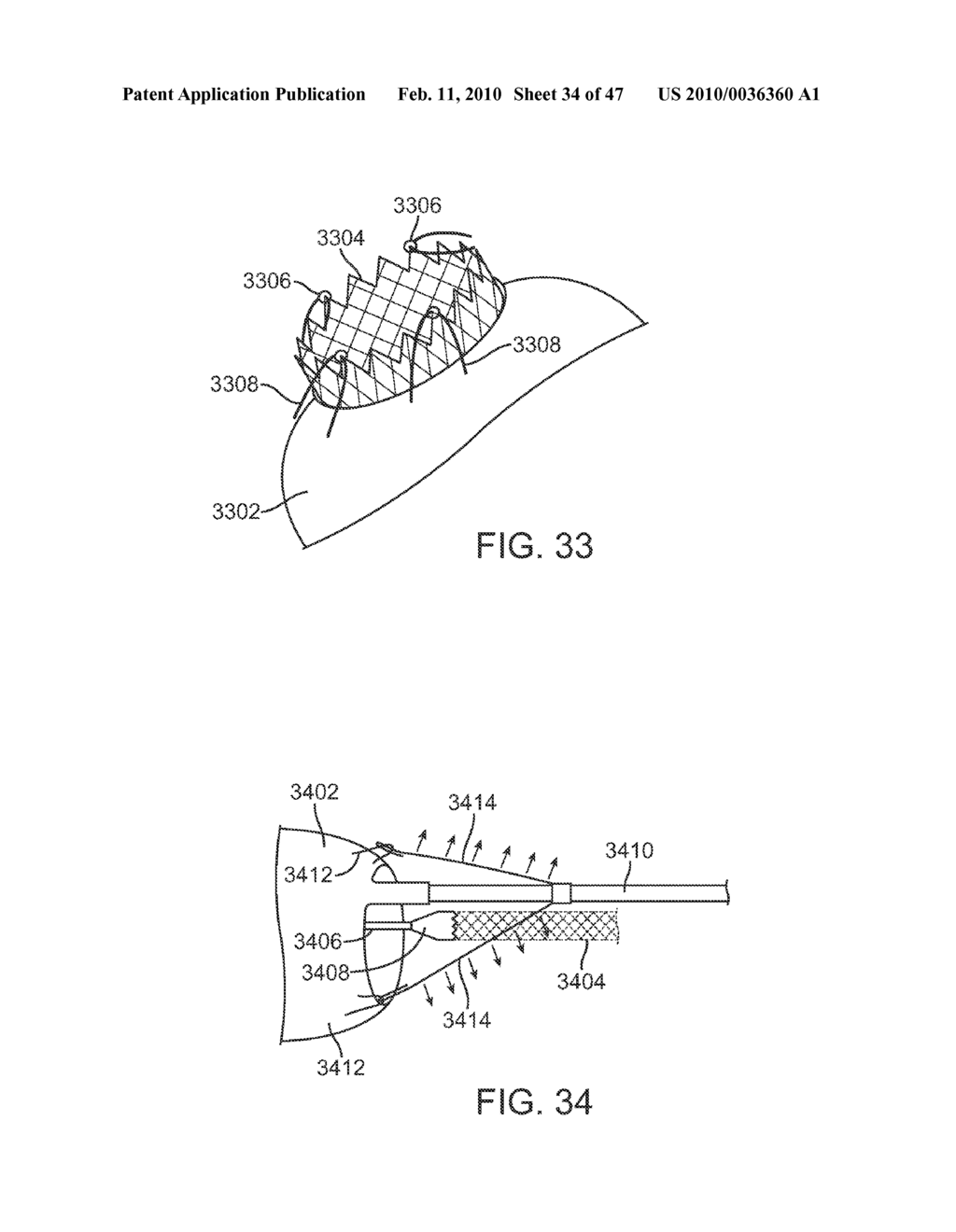 STENT GRAFT DELIVERY SYSTEM - diagram, schematic, and image 35