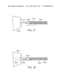 STENT GRAFT DELIVERY SYSTEM diagram and image