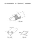 STENT GRAFT DELIVERY SYSTEM diagram and image