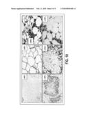 Method of selectively heating adipose tissue diagram and image