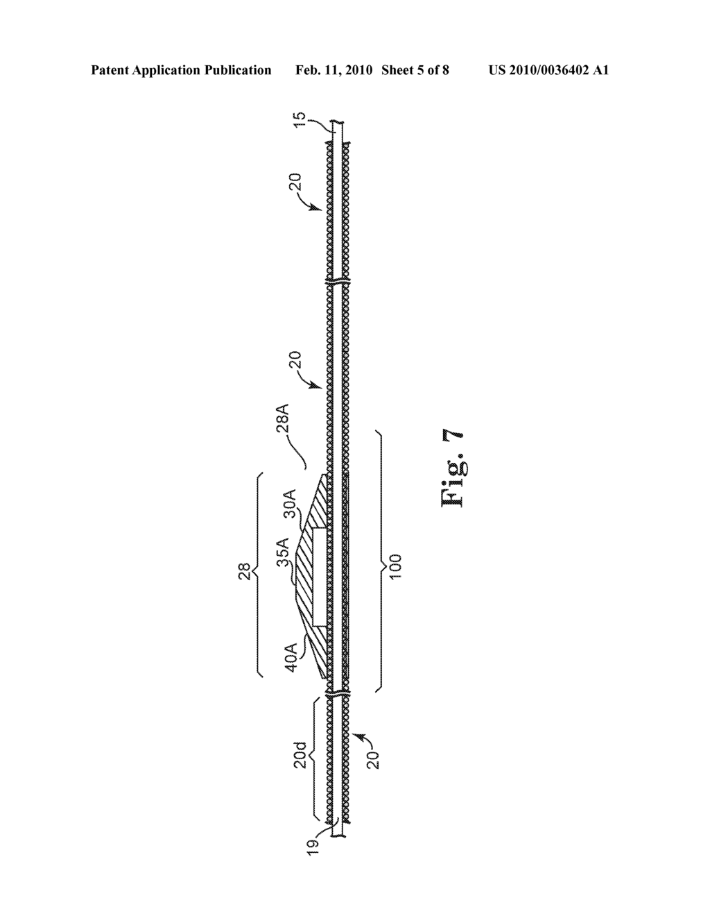 ROTATIONAL ATHERECTOMY DEVICE WITH PRE-CURVED DRIVE SHAFT - diagram, schematic, and image 06