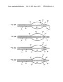 APPARATUS AND METHODS FOR TREATING OBSTRUCTIONS WITHIN BODY LUMENS diagram and image