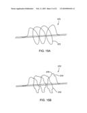 APPARATUS AND METHODS FOR TREATING OBSTRUCTIONS WITHIN BODY LUMENS diagram and image