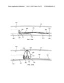 APPARATUS AND METHODS FOR TREATING OBSTRUCTIONS WITHIN BODY LUMENS diagram and image